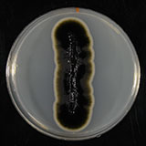 黒色酵母菌